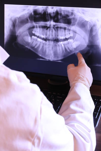 Best Root Canal Emergency Dentist  in Montgomery, IL