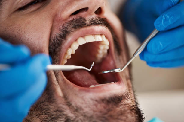 Best Affordable Emergency Dental Care  in Montgomery, IL